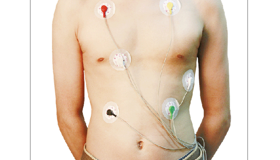 动态心电图（Holter）