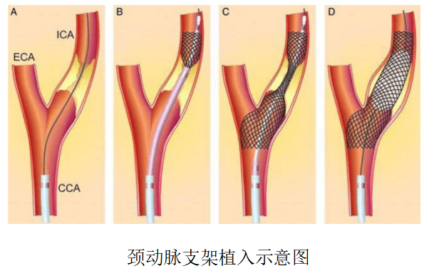 添加图片描述