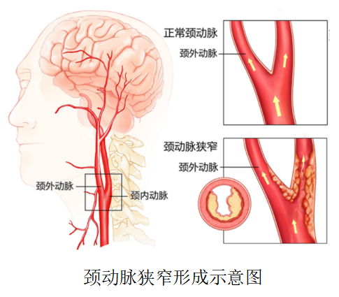 添加图片描述