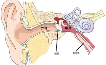 耳朵里的炸弹—胆脂瘤型中耳炎