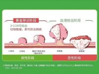 病理科||一管血，助力肠癌早筛新“肠”识——S9基因甲基化检测的
